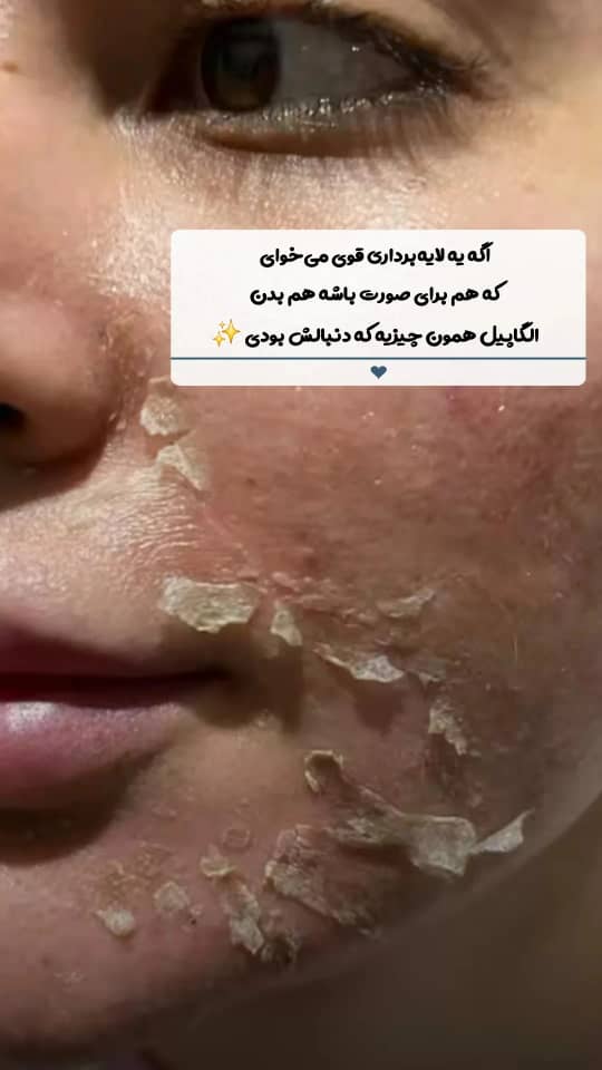 خدمات پاکسازی و درمان پوست یلدا اکبری در شیراز